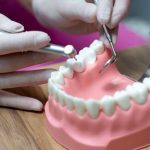 The Hidden World of Dental Biofilms and Their Impact on Your Oral Microbiome
