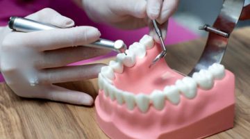 The Hidden World of Dental Biofilms and Their Impact on Your Oral Microbiome